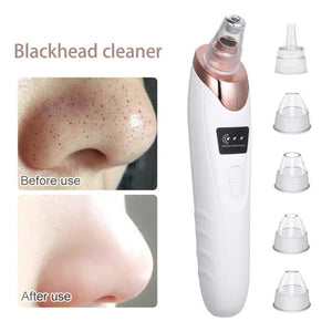 Electric blackhead remover