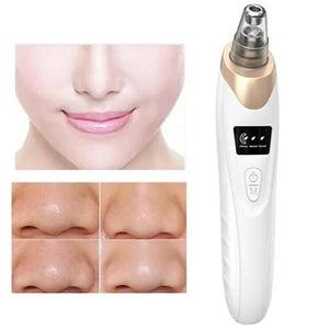 Electric blackhead remover