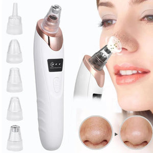 Electric blackhead remover